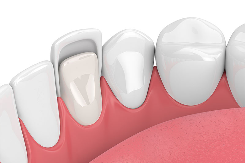 Quality Dental Treatments in Fulshear